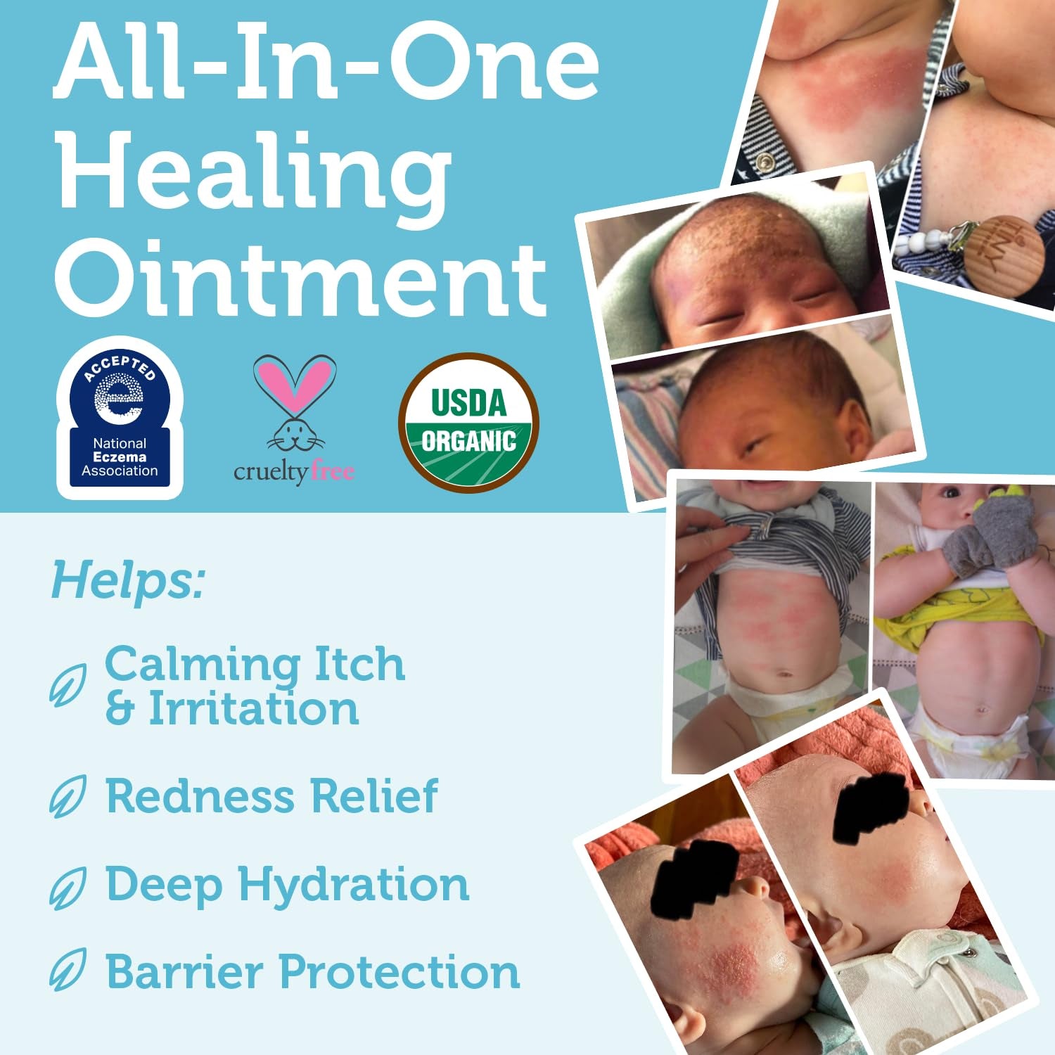 Healing Ointment for Babies - USDA Certified Organic Natural Moisturizer Gentle on Sensitive Skin Prone to Baby Eczema, Cradle Cap (Infant Seborrheic Dermatitis), Rashes, Hives 2Oz