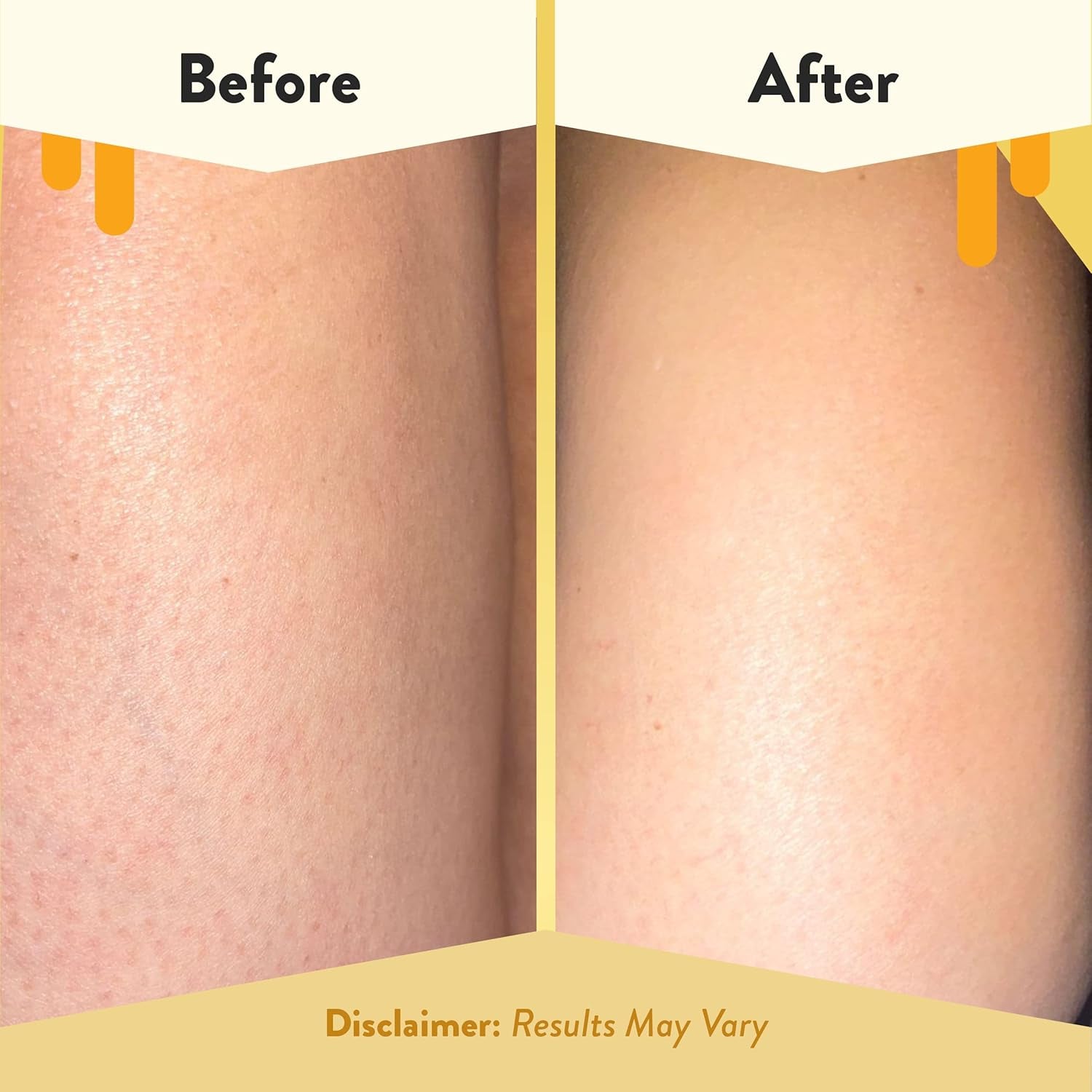 Soothing Body Wash - Daily Shower Gel & Eczema Treatment - Sensitive Skin Body Wash for Adults, Kids, & Babies - Body Cleanser for Eczema Relief (13 Oz)