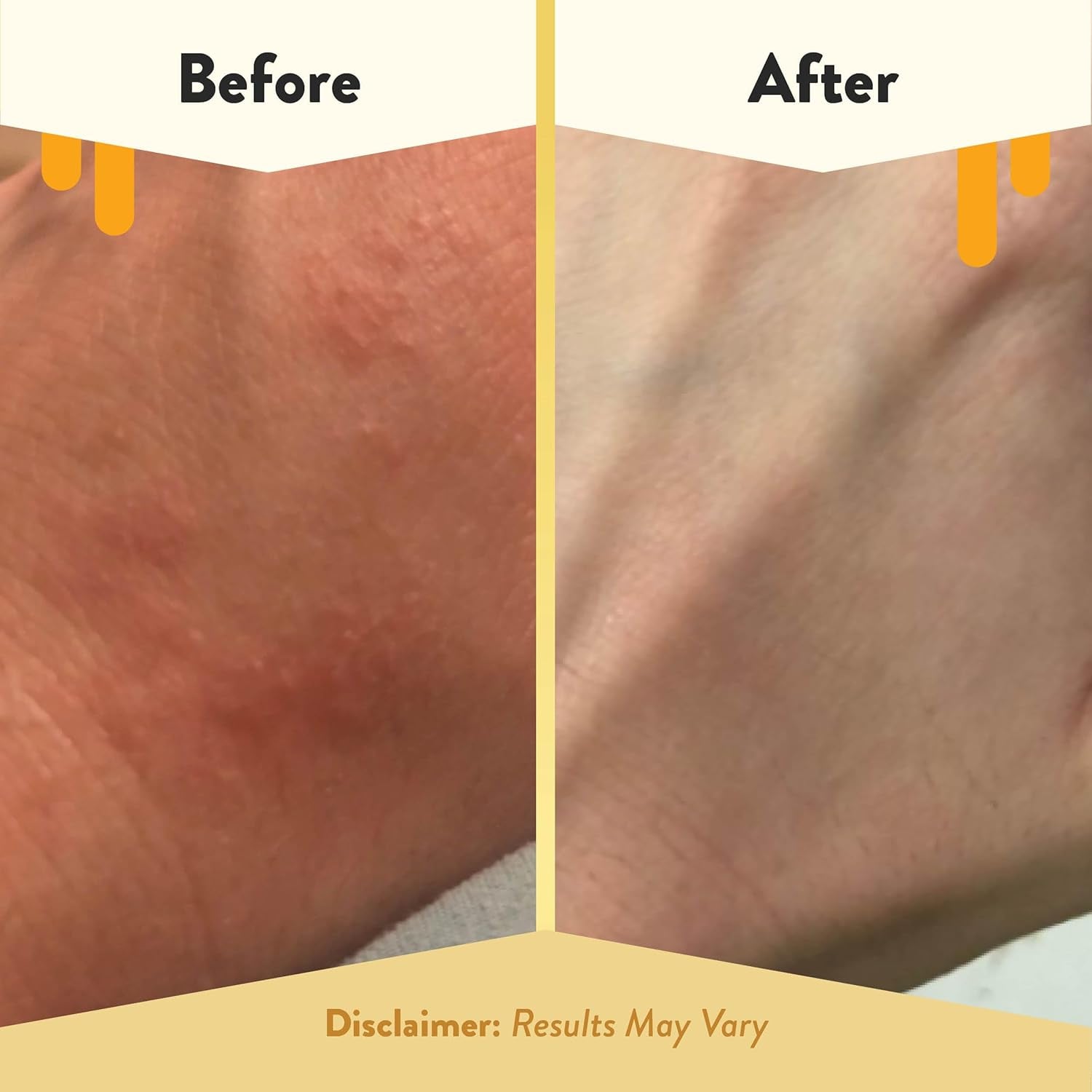 Oatmeal Body Lotion - Hand & Body Cream for Eczema Relief - Natural Dry Skin Repair (16 Oz)