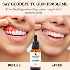 Neem & Clove Gum Healer