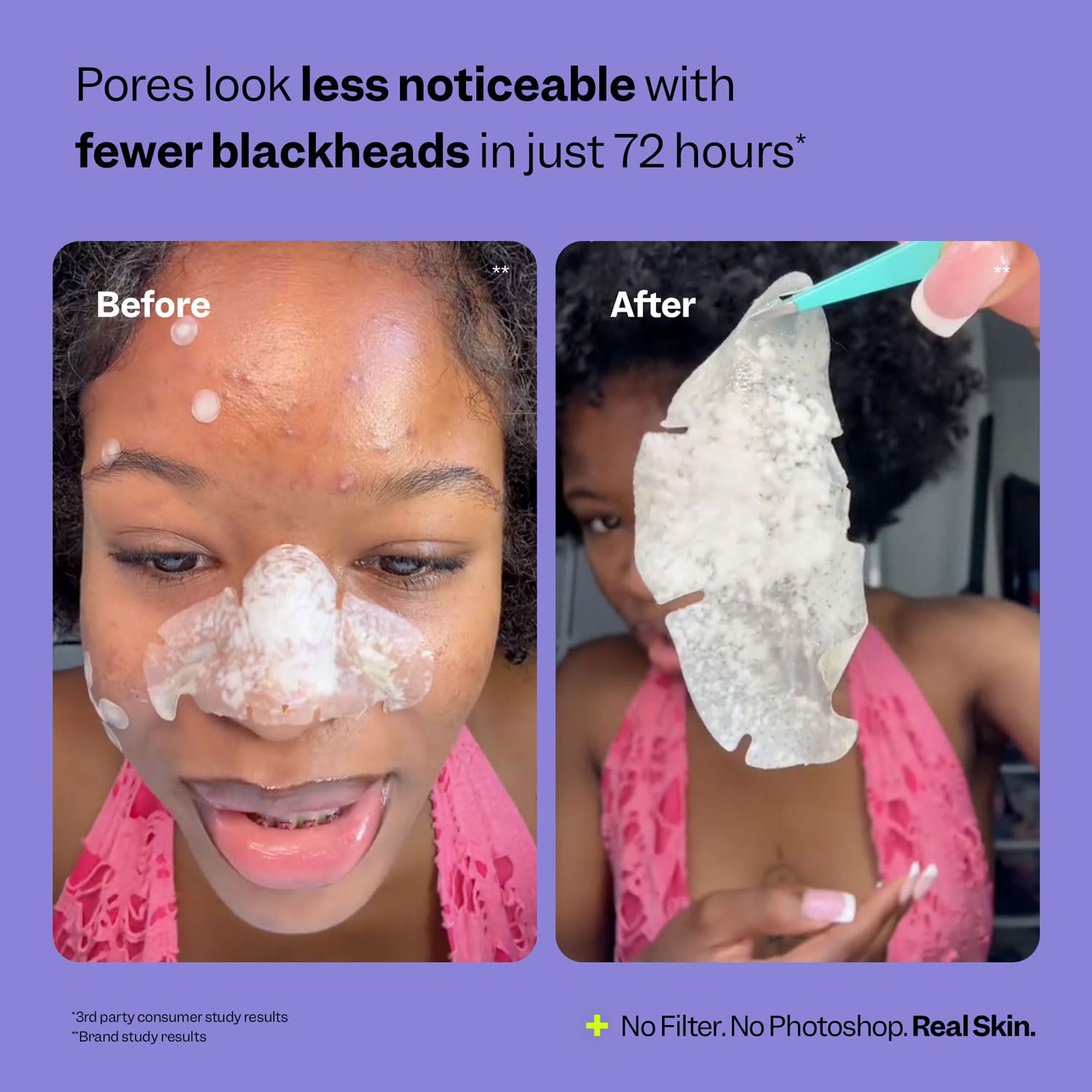 Pore Perfect Patches