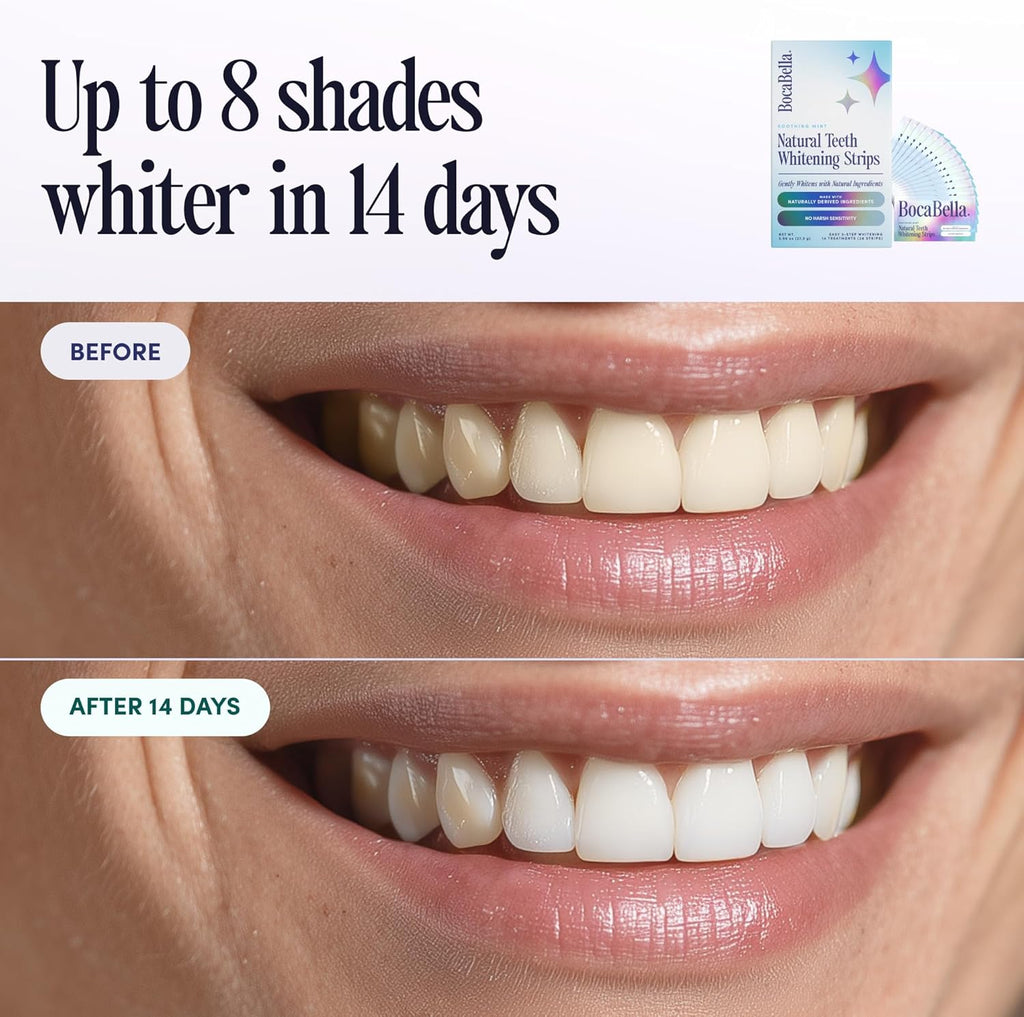 BrightSmile Enzyme Whitening Strips