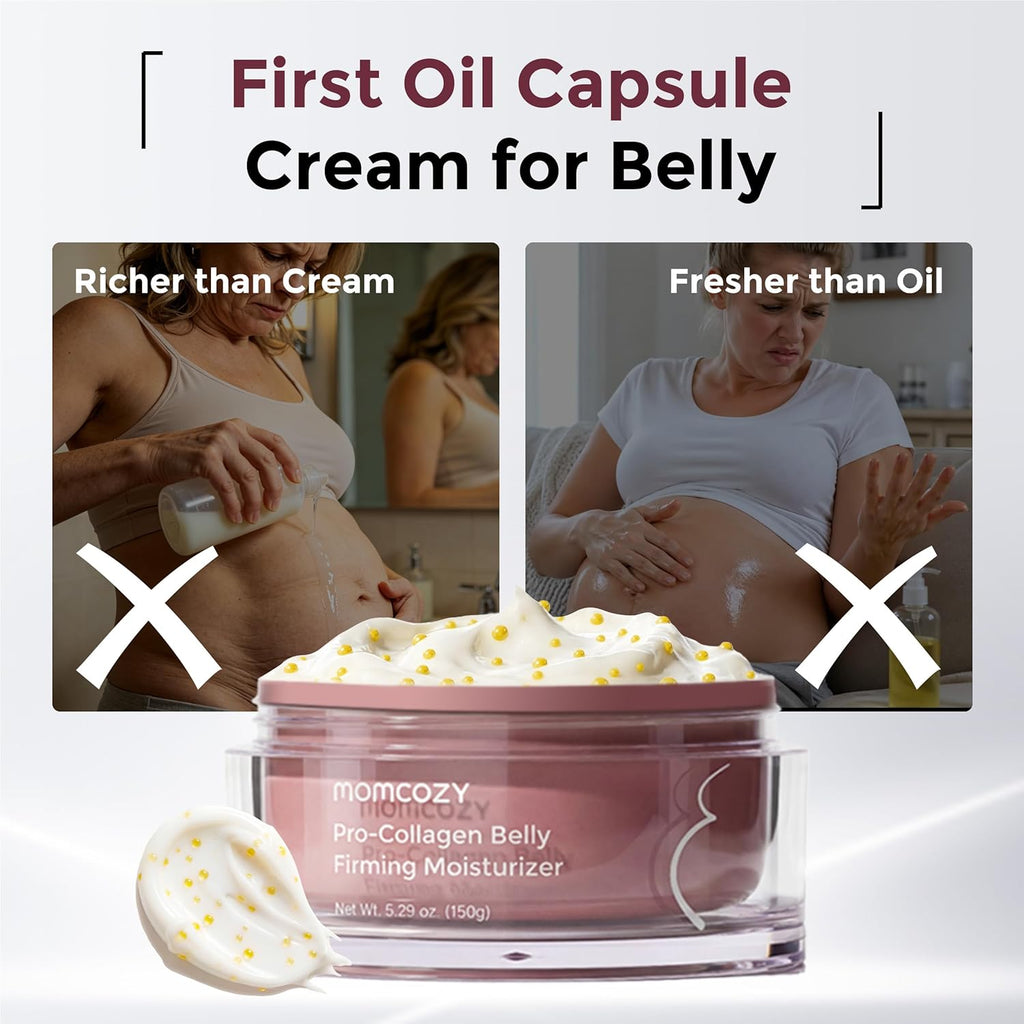 Gentle Stretch Mark Cream