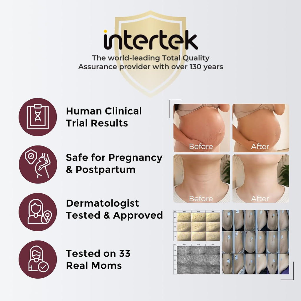 Gentle Stretch Mark Cream