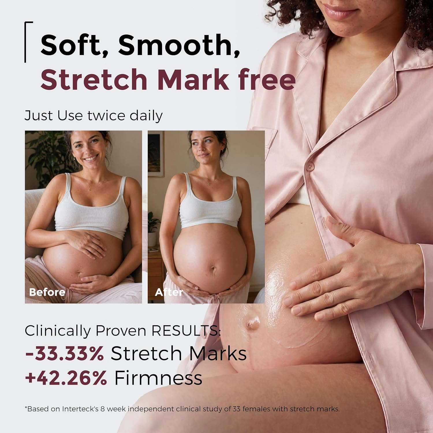 Gentle Stretch Mark Cream