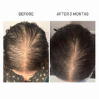 Mom's Hair Renewal Oil
