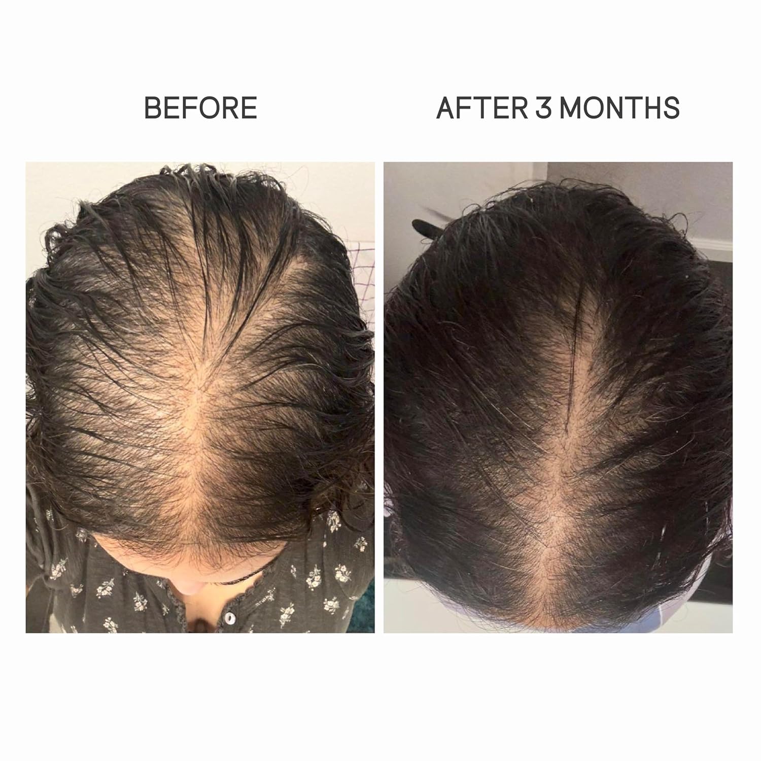 Mom's Hair Renewal Oil