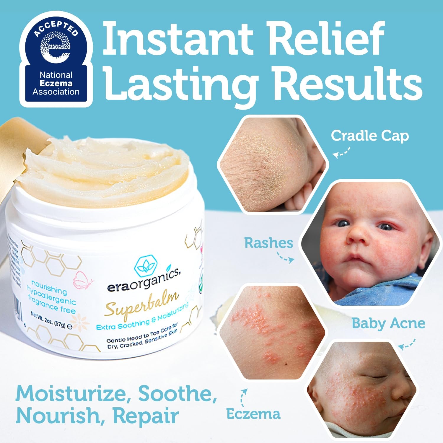 Healing Ointment for Babies - USDA Certified Organic Natural Moisturizer Gentle on Sensitive Skin Prone to Baby Eczema, Cradle Cap (Infant Seborrheic Dermatitis), Rashes, Hives 2Oz