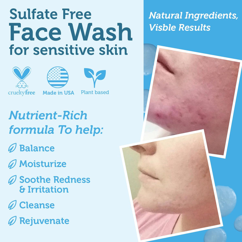 Manuka Honey Face Wash for Sensitive Skin - Sulfate Free Gentle Cleanser with Organic Aloe Vera, Hyaluronic Acid & More - Soothing & Moisturizing for Dry Skin - Made in USA (4 Oz)