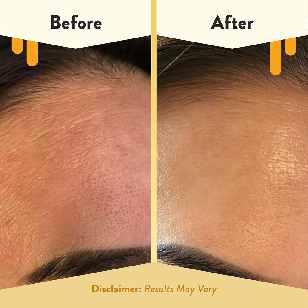 Oatmeal Facial Cleanser - Natural Eczema Face Wash Prevents Breakouts - Daily Gentle Face Cleanser for Dry, Itchy, Sensitive, & Irritable Skin (6 Oz)