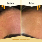 Oatmeal Facial Cleanser - Natural Eczema Face Wash Prevents Breakouts - Daily Gentle Face Cleanser for Dry, Itchy, Sensitive, & Irritable Skin (6 Oz)